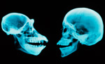 11) X-ray: Skulls of a chimpanzee and a human.