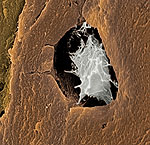 5) Photo: Bone cells.