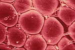 8) Photo: Fat cells.