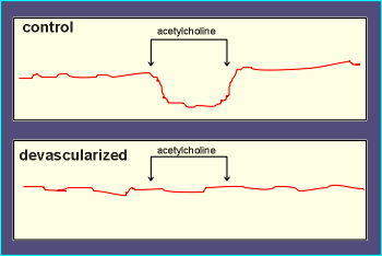 edrfRESULTS.gif (6727 bytes)