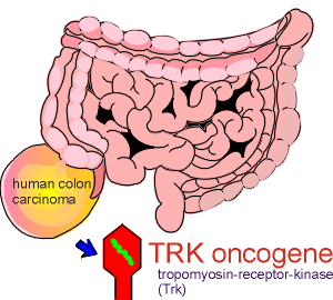 trkonco.gif (25045 bytes)